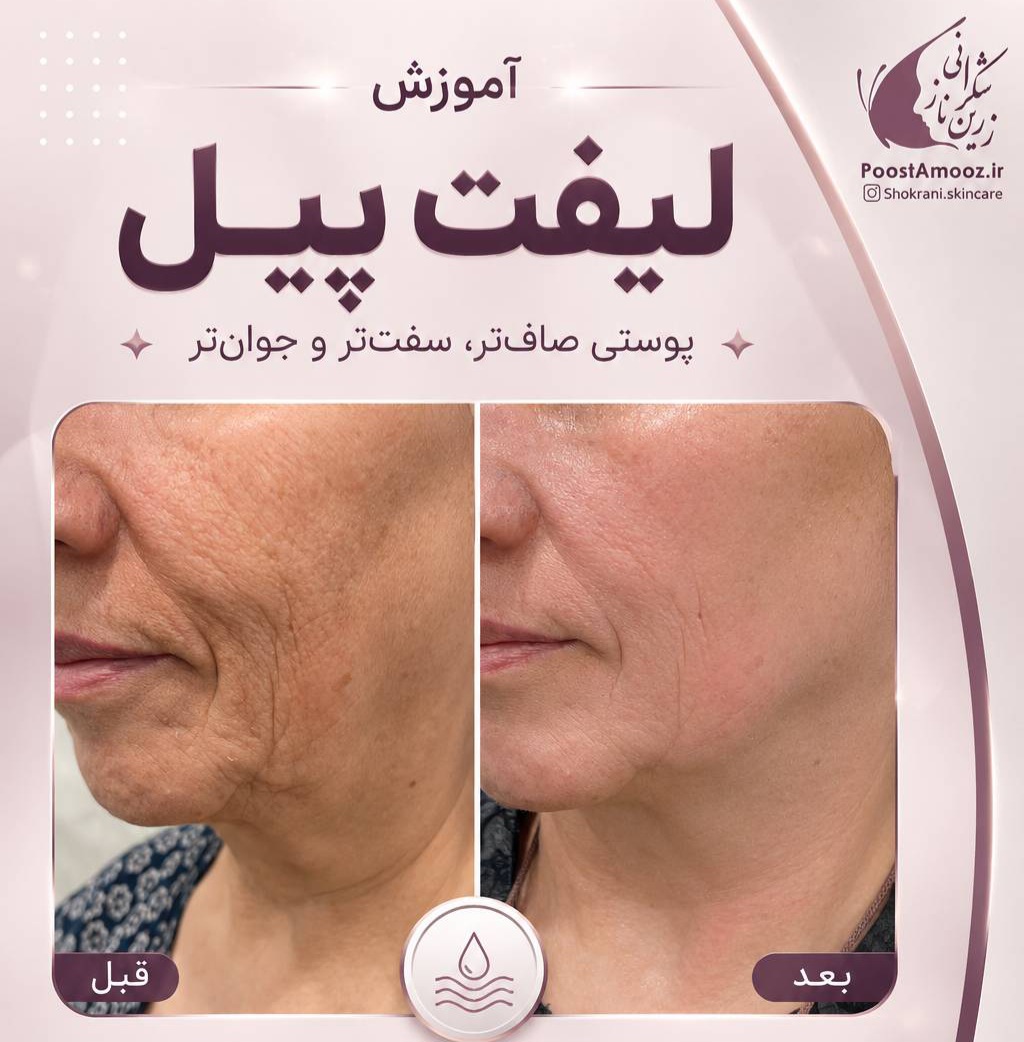 آموزش لیفت پیل با استاد شکرانی